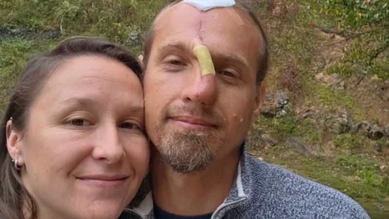 Life changed in a split second the moment Dustin Low tried to break up a fight between two...
