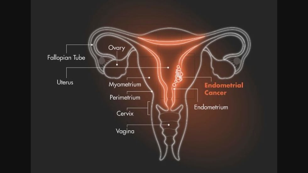 GSK/Don’t Be Embarrassed Endometrium Diagram