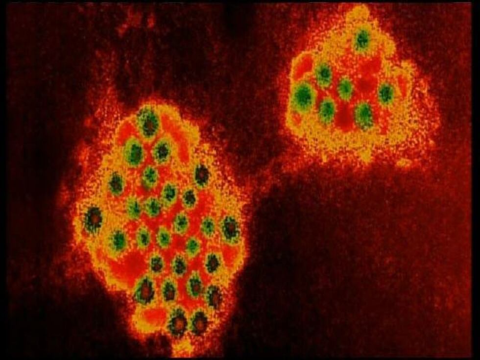 File photo (Source: WOIO)