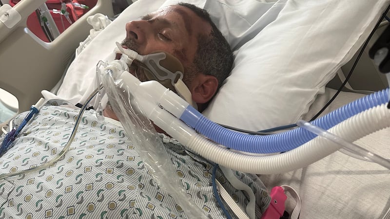 Man hit while working road construction says driver's fine didn't match the damage