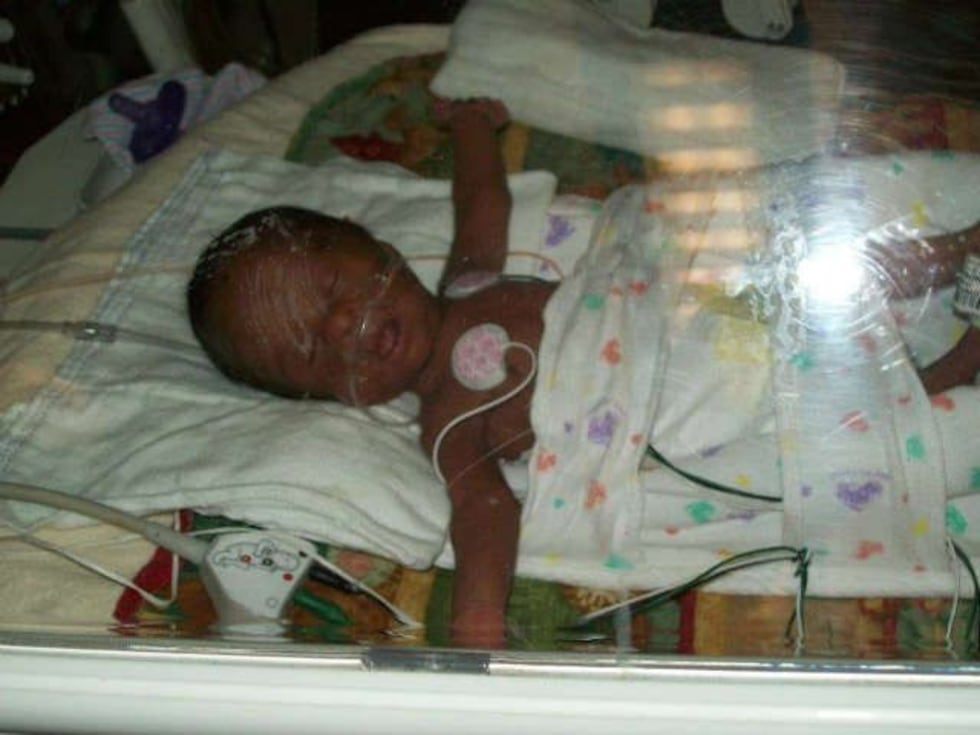 Little JoJo in the NICU. (Source: WOIO)